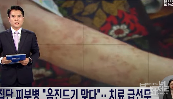 옴 주의보 떴다...옴 예방을 위한 위생 관리 당부